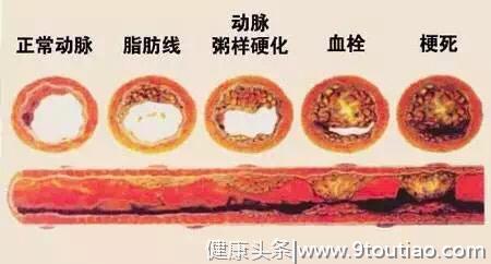 人体內的毒素