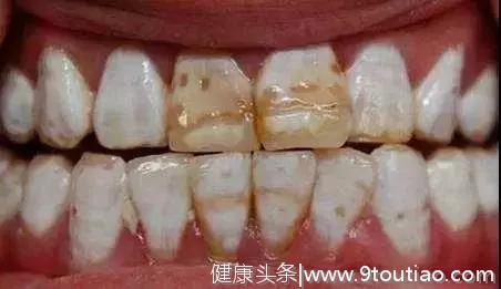 牙齿黄了是病吗？