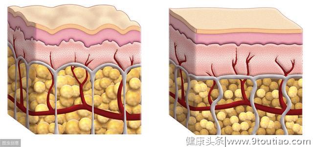 吃红肉致癌？引发炎症？类风湿，痛风病人可以吃么？