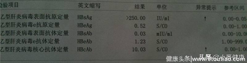 乙肝15阳性说明什么，大三阳与小三阳之间，属于不稳定状态