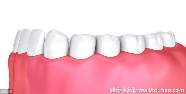 “牙不老，人不老”常见牙齿四大误区，听听医生怎么说