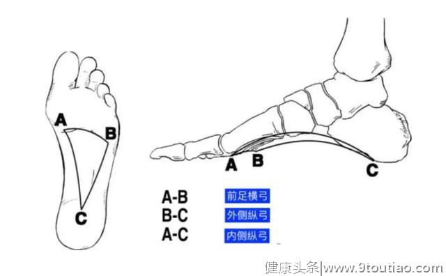 腰痛，膝盖痛，也许是你的脚出了问题