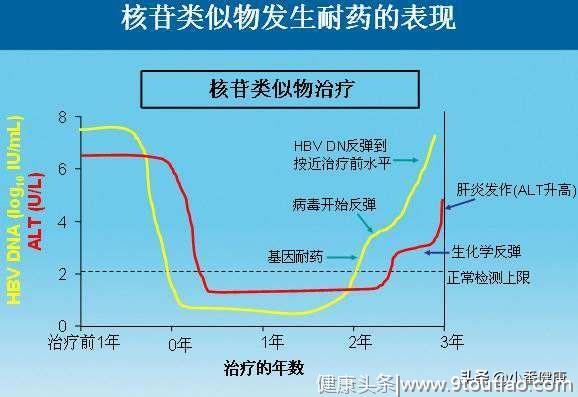 乙肝小三阳肝功能异常的主要原因