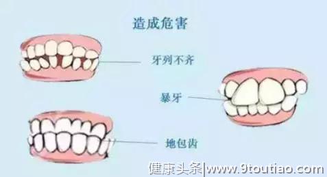 笑出整齐“八颗牙”，孩子换牙期需要知道的那些事儿