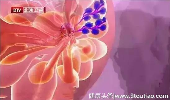 胸部出现“小酒窝”，当心是乳腺肿瘤！做好4件事，远离女性杀手