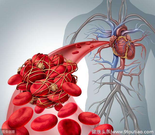 中医：冠心病最怕血管堵塞，做好这5点比治疗更重要