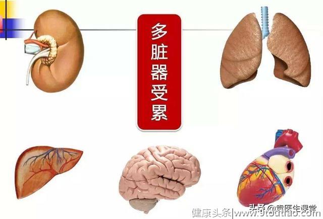 医生科普：什么是恶性类风湿关节炎，会引起身体其它器官的病变