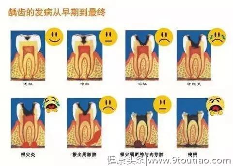 不发黑的牙齿就是健康的？实际上这种牙病已经找上你的牙齿