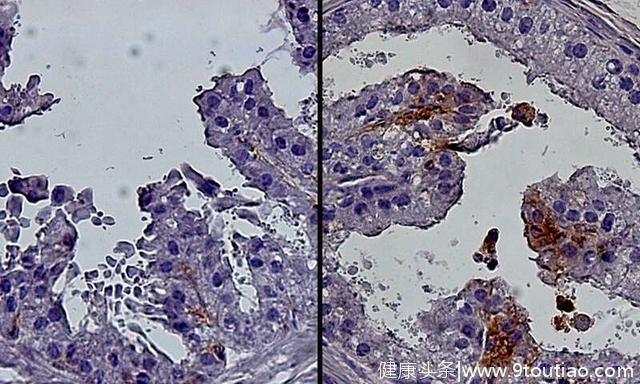 研究将祖细胞与年龄相关的前列腺生长联系起来