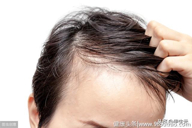 哪种原因容易导致脱发？