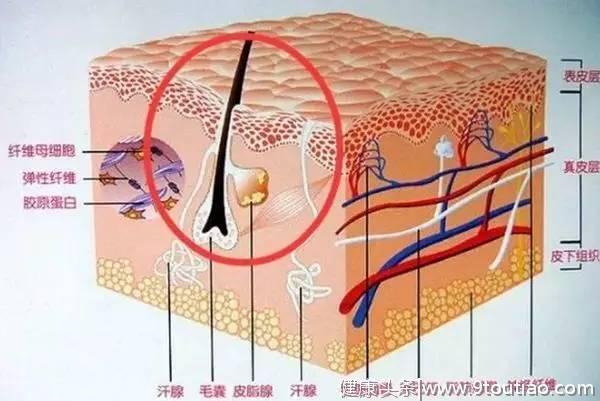 关于治疗脱发，你都踩过哪些坑，这4个毛囊问题需要知道