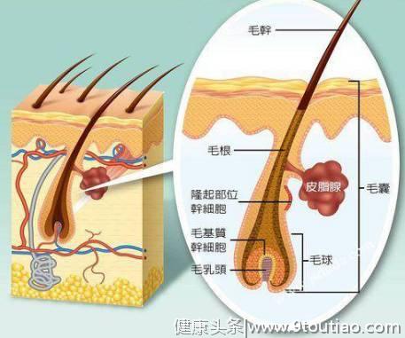 关于治疗脱发，你都踩过哪些坑，这4个毛囊问题需要知道