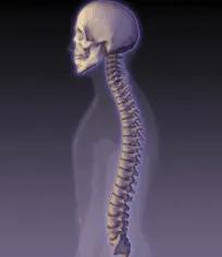 强直性脊柱关节炎并非“不死的癌症”