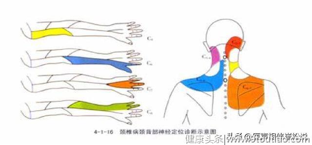 关注颈椎病！看看你的脖子还好吗？