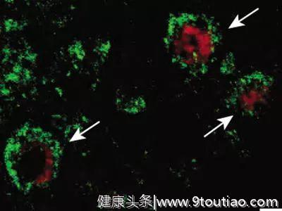 5年探索，中国女科学家捕获抑郁症元凶，成果将拯救数亿人