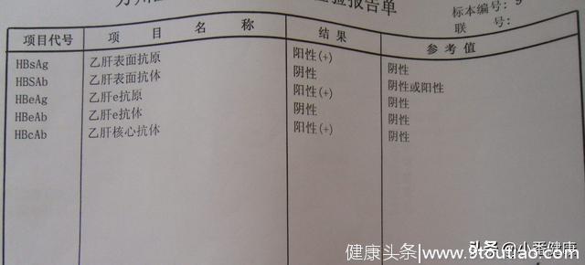 年龄增长与乙肝自发转阴的指标监测