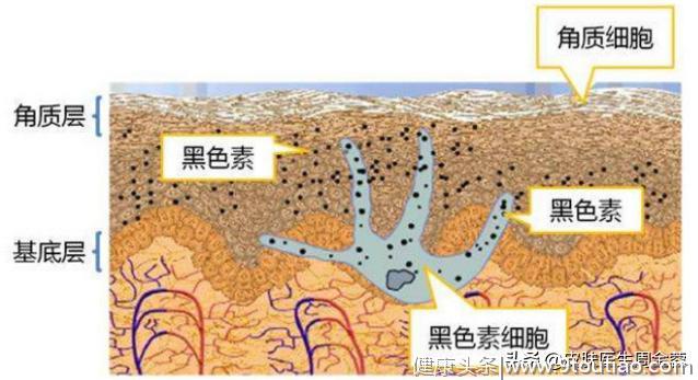 白癜风发生的本质，不知道的话，可以了解一下