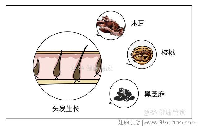 得了类风湿，每天头发掉得也太太太太太多了吧