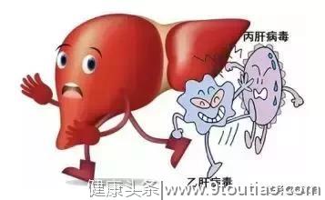 艾滋已经“防治到位”，但丙肝却“异军突起”成为HIV感染者死因