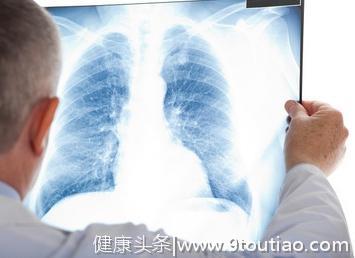 发现肺部小结节怎么办？