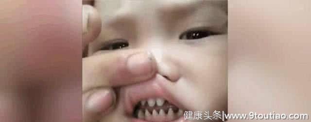 小宝宝竟长了一副鲨鱼“牙齿”，而大人的手指甲遭到网友的批评！