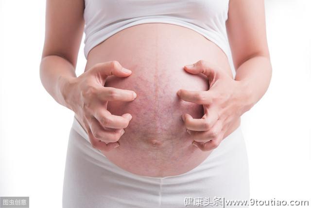 怀孕了，涂橄榄油还会长妊娠纹吗？