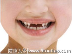 孩子牙齿健康知识 小孩子龅牙怎么办