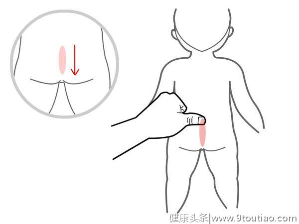 小儿实证便秘简易偏方贴肚脐