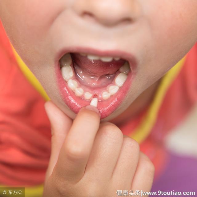 警惕！孩子的牙齿如果是这个样子！你就
