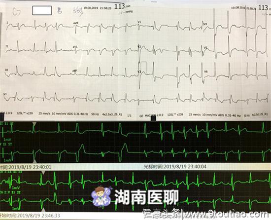 大叔喝治疗风湿药酒中毒了？全身麻木呼吸困难，一两可致命？