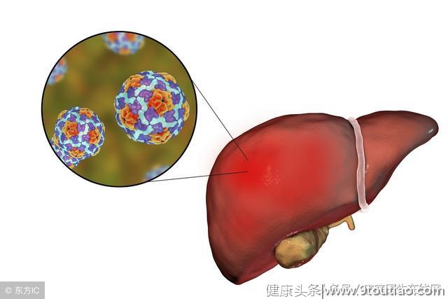 慢性肝炎或会发展成肝癌！医生：这一肝炎可治愈却少有人知