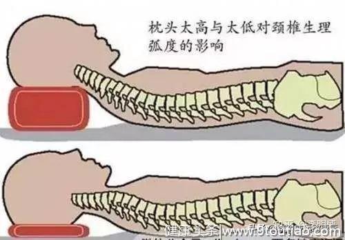 日常哪些行为会引发颈椎恶化是你没想到的？