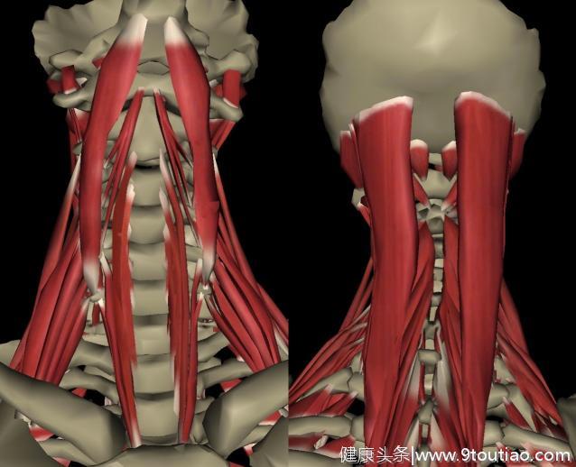 颈椎康复的3大法宝：松弛肌肉、复位关节、强化力量！坚持可痊愈