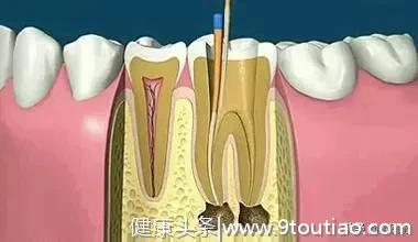 最全的口腔医嘱！亲收藏一下