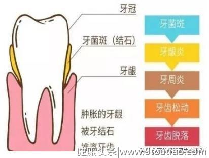 还不看牙洗牙？自己测测牙齿是否真的健康吧？