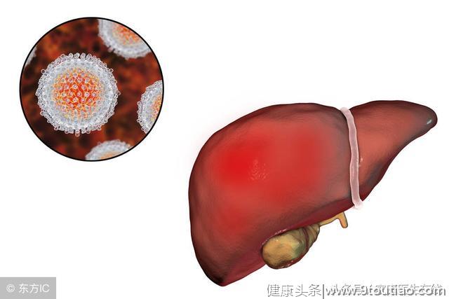 乙肝患者，身体出现这几个变化，说明离肝癌不远了