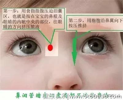 儿童常见的眼科疾病