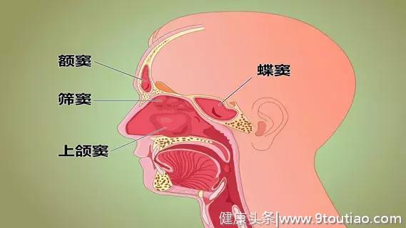 鼻窦炎与鼻炎有何不同？关于鼻窦炎的5个问题