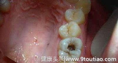 口腔疾病有哪些？