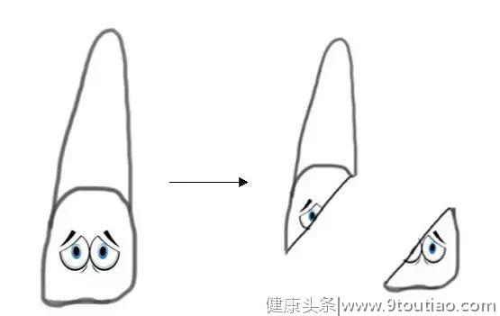 关键时刻，怎么拯救自己的牙齿？