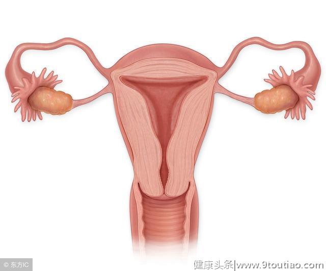 子宫肌瘤的四大饮食禁忌及子宫肌留的饮食原则