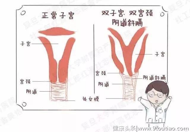 一个女人有两个子宫是一种什么体验？