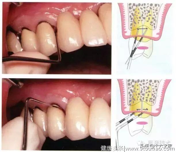 「牙周组织检查」牙齿的解剖形态（一）