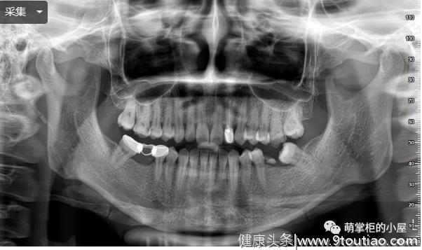 有看牙可以报销的齿科保险，你知道吗？