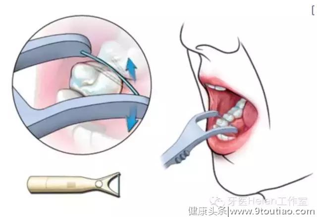 牙医Helen齿科中心——如何保养牙齿