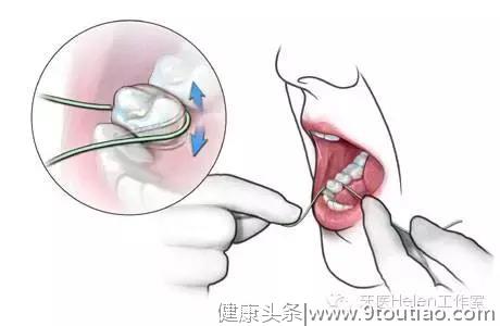 牙医Helen齿科中心——如何保养牙齿