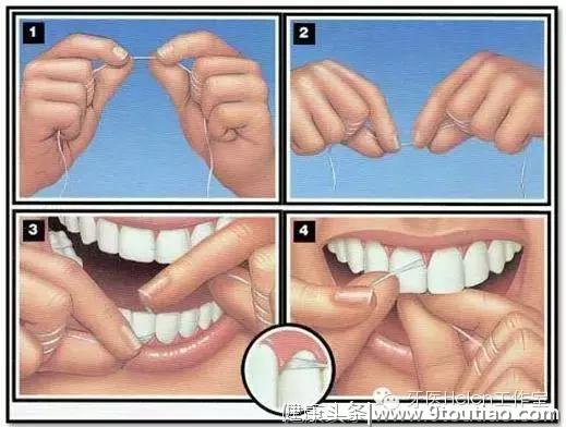 牙医Helen齿科中心——如何保养牙齿