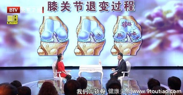 腿疼就是关节炎？医生提醒：这种“腿疼”，可能是血管出了大问题