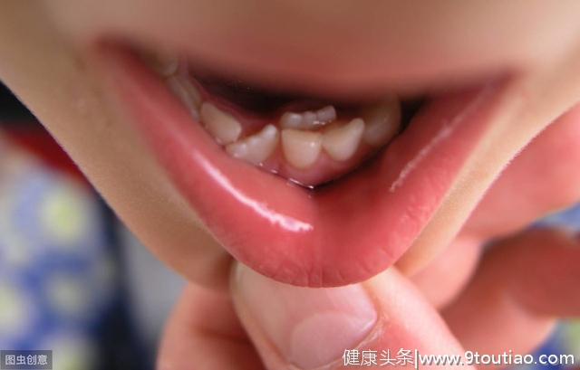牙齿排列不齐，影响颜值，什么时候是矫正的黄金时期？