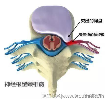 颈椎病里的五花三层—颈椎的结构和功能